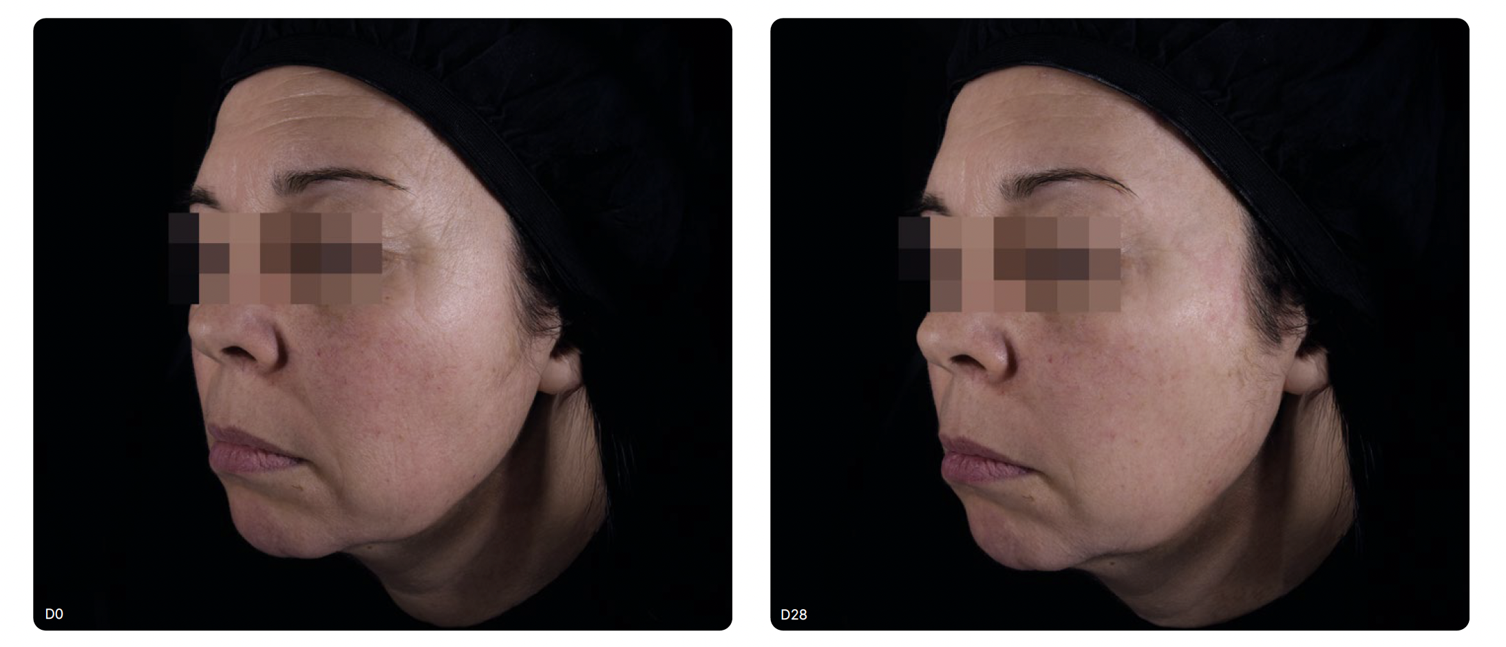clinique aethelis granata anti-aging